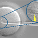 Illustration for article titled The Last-Ditch Fertilization Method For Infertile Men Just Got More Reliable